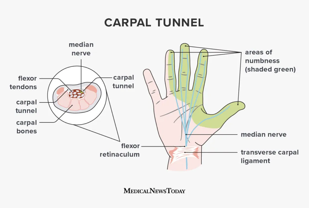 carpal